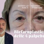 Il Dott. Luca Cravero spiega la blefaroplastica delle 4 palpebre con borse malari e terzo medio