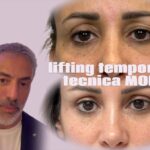 Il Dott. Luca Cravero mostra il gesto che orienta verso il lifting temporale